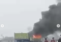 Kondisi Terkini Kaki Bocah yang Dilindas Truk Pasir di Tangerang