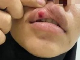 Dianiaya Suami Sampai Pingsan, Warga Pembataan Lapor Polisi