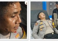 Kapolres Mamberamo Tengah Dihantam Anak Panah di Pipi saat Amankan Pilkada, Aksi Anarkis Pendukung Calon!