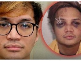 WNI Predator Seks Terkeji di Inggris Dihajar Napi di Penjara, Wajah Reynhard Sinaga Penuh Labam