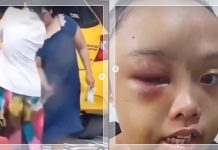 VIRAL! ART Masih Anak-anak di Riau Disiksa Majikan, Dipukul Sapu dan Disuruh Tidur di Gudang