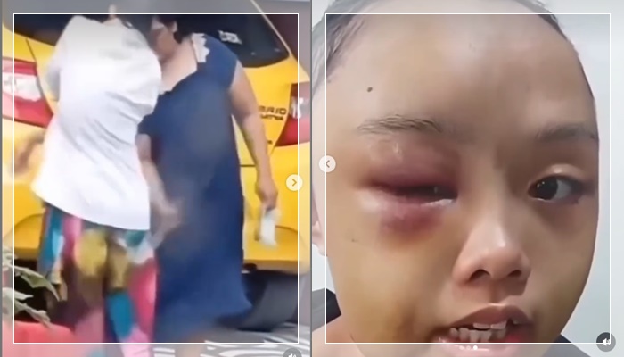 VIRAL! ART Masih Anak-anak di Riau Disiksa Majikan, Dipukul Sapu dan Disuruh Tidur di Gudang