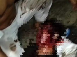 Perkelahian di Martapura, Pemuda ini Babak Belur Dipukuli Pelaku