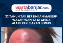 VIDEO - 22 Tahun Tak Bersihkan Makeup, Wajah Wanita di China Alami Kerusakan Serius
