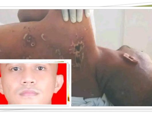 Kasus Prada Lucky, Prajurit Muda yang Tewas Disiksa Senior, 4 Tentara Diamankan POM TNI