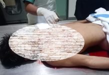 NGERI! Pemuda Tewas Terjepit Truk dan Kontainer di Pelabuhan Trisakti, Diduga Salah Komunikasi