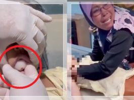 Tragis! Bocah di Malaysia Tewas Tersedak Buah Rambutan, Ini Bahaya Fatal yang Harus Diwaspadai Orang Tua!