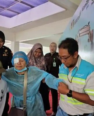 Senyum Ziki Saat Penglihatan Kembali Normal, Adaro Gelar Operasi Katarak Gratis di Balangan