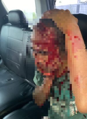 Perkelahian Dekat Kantor Pegadaian Rantau, Pelaku Tebas Korban di Kepala