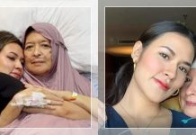 Ibunda Raisa Wafat karena Kanker Paru: Pakar Ingatkan Bahaya Senyap &amp; Pentingnya Skrining Dini