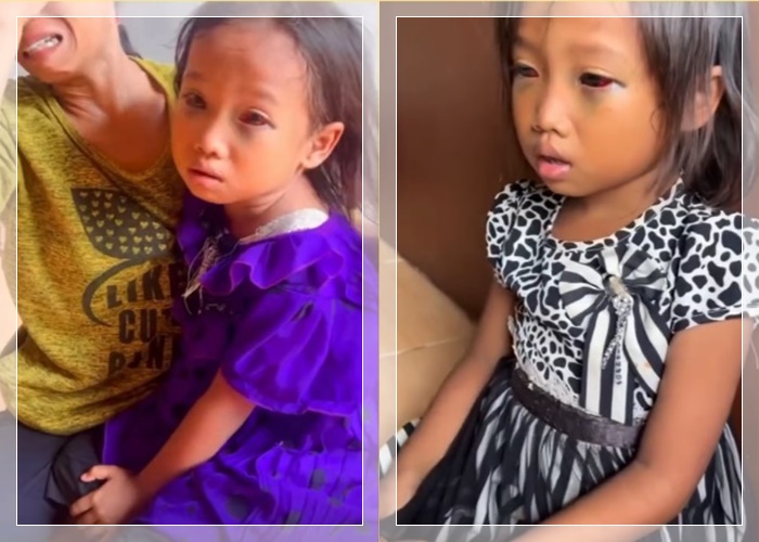 mata anak