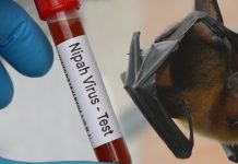 VIRUS NIPAH Kembali Merebak di India, Ancaman Mematikan dengan Fatalitas Tinggi hingga 75 Persen