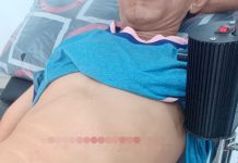 Pesta Miras Oplosan Berujung Pengeroyokan, Dua Residivis Aniaya Warga di Banjarmasin Selatan