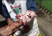 4 Warga Hantakan Digigit Anjing, Korban Disuntik Vaksin Anti Rabies dan Dipantau 21 Hari