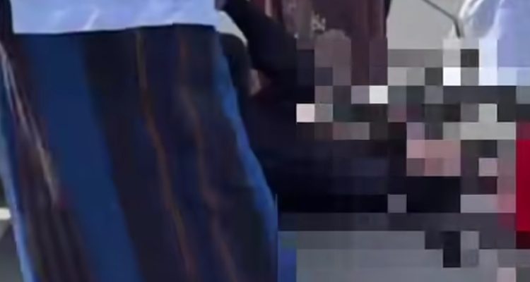 Pengendara di Bayur HSU Alami Luka di Kepala Akibat Gamis Terlilit Rantai Motor