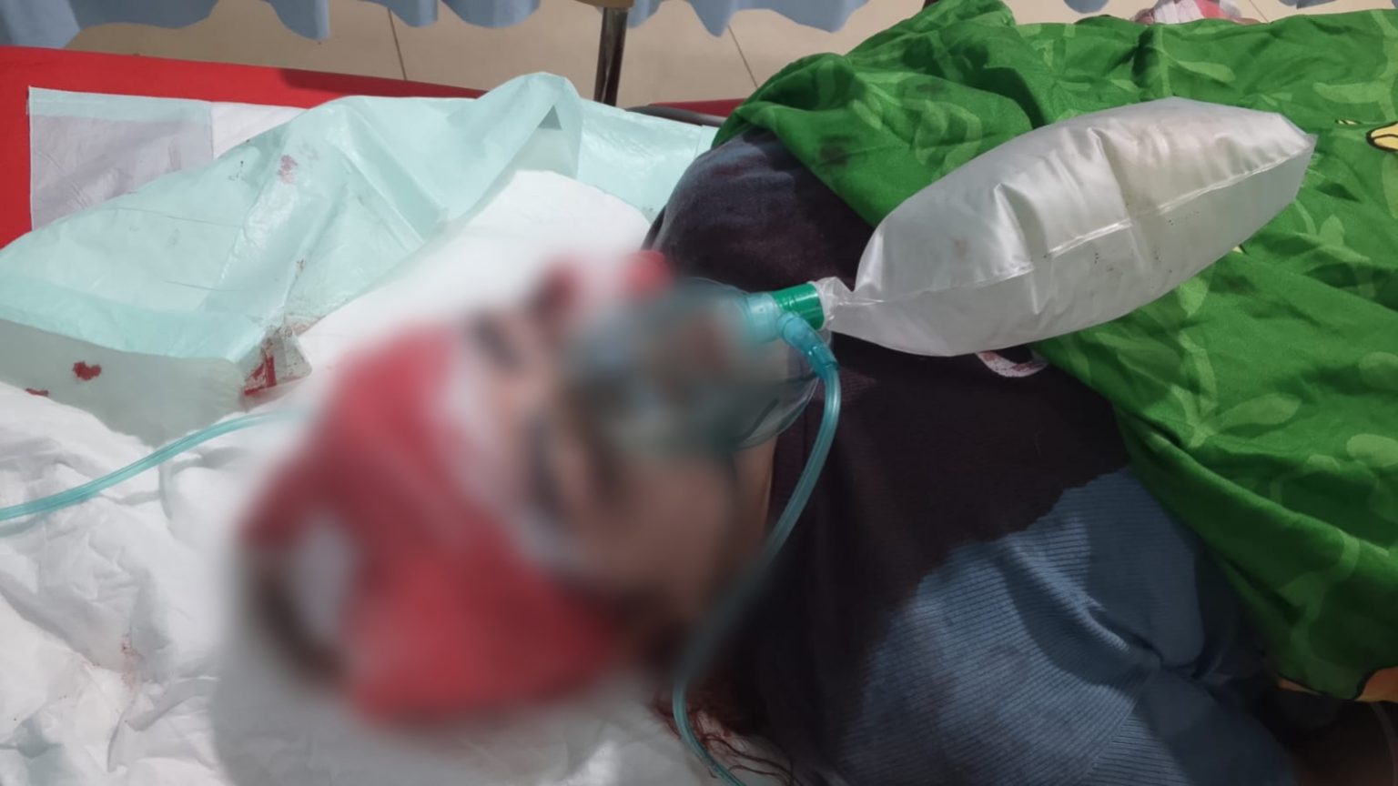Sakit Hati Diputus Cinta, Seorang Pria Tusuk sang Pacar di Kijang Mas Pelaihari Tanah Laut