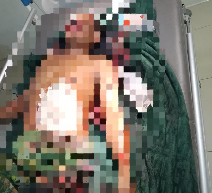 Duel Berdarah di Tajau Pecah Tanah Laut, Penimbang Rongsokan Dioperasi, Satu Pelaku Ditangkap