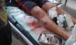 paha kanan Dimas digigit buaya Sungai Jampau