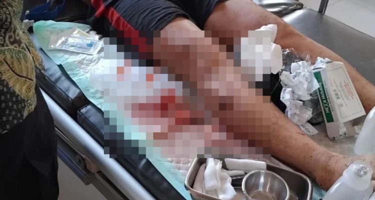 paha kanan Dimas digigit buaya Sungai Jampau